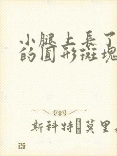 小腿上长了红色的圆形斑块