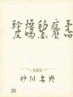 干燥的症手会脱皮吗怎么治啊