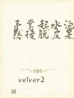 手掌起水泡不痒然后脱皮是什么原因