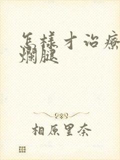 怎样才治疗好老烂腿