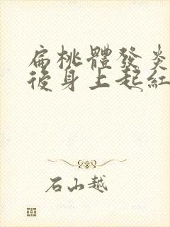 扁桃体发炎发烧后身上起红疹子怎么回事