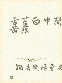 舌苔白中间黄有齿痕