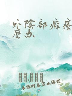 外阴部癣瘙痒怎么办