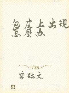 包皮上出现流脓怎么办