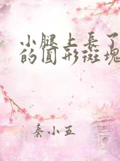 小腿上长了红色的圆形斑块