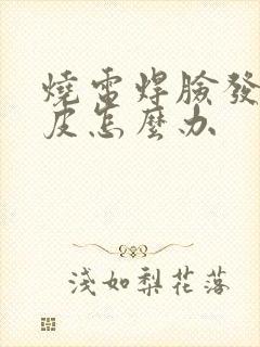 烧电焊脸发红脱皮怎么办