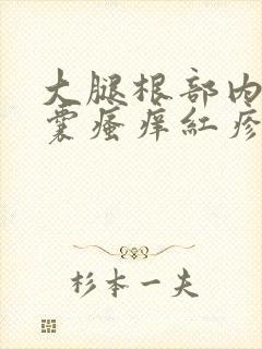 大腿根部内侧阴囊瘙痒红疹用什么药膏