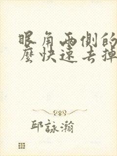 眼角两侧的斑怎么快速去掉