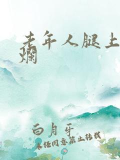 老年人腿上有溃烂