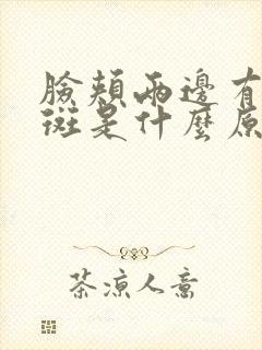 脸颊两边有黄褐斑是什么原因