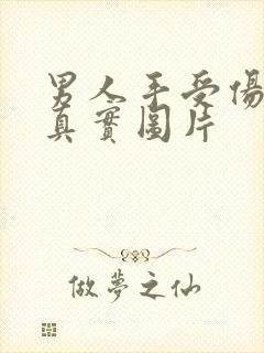 男人手受伤图片真实图片封面