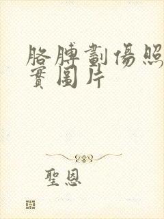 胳膊划伤照片真实图片