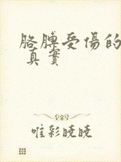 胳膊受伤的图片 真实封面