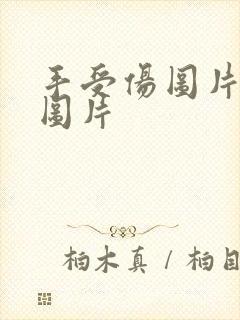 手受伤图片真实图片