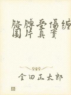 胳膊受伤缠纱布图片真实