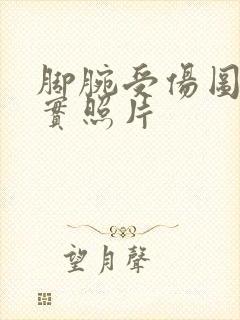 脚腕受伤图片真实照片封面