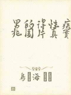 男的得性疾病前兆图片真实