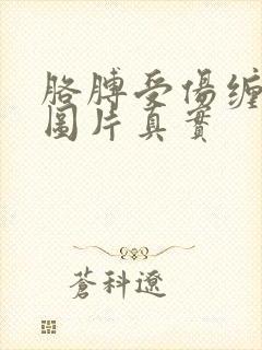 胳膊受伤缠纱布图片真实封面