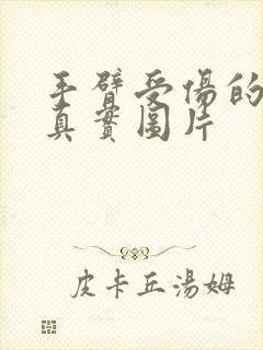 手臂受伤的照片真实图片