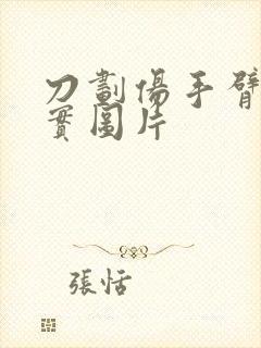 刀划伤手臂的真实图片