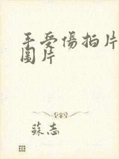 手受伤拍片子的图片