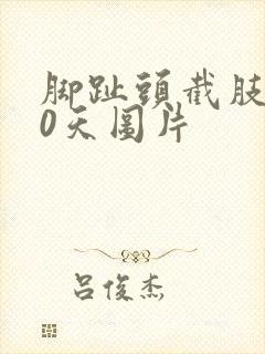 脚趾头截肢了50天图片