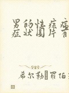 男的性疾病前期症状图片有哪些