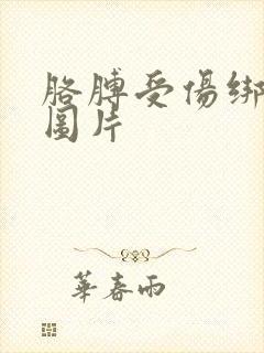 胳膊受伤绑绷带图片