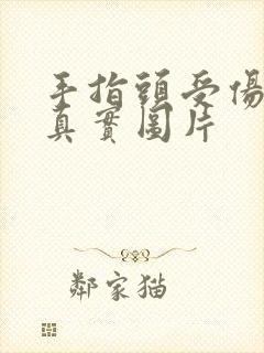 手指头受伤图片真实图片