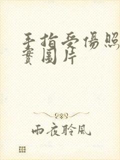 手指受伤照片真实图片