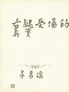 右腿受伤的图片真实
