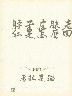 脖子皮肤老痒还红是怎么回事