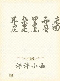 耳朵里面老是起皮是怎么回事