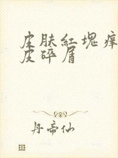 皮肤红块痒干脱皮碎屑