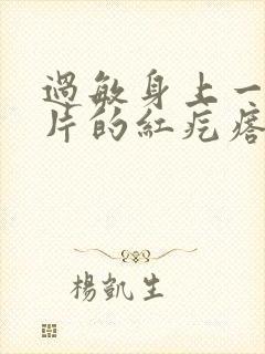 过敏身上一片一片的红疙瘩疼痒