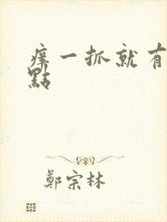 痒一抓就有小血点封面