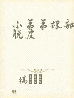 小弟弟根部发痒脱皮