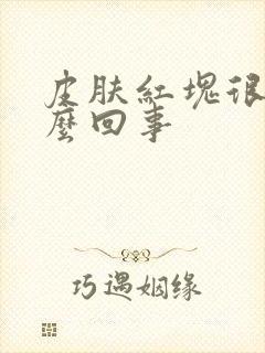 皮肤红块很痒怎么回事