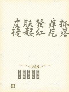 皮肤发痒抓了之后起红疙瘩是怎么回事