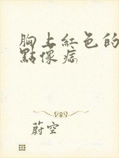 胸上红色的小血点像痣