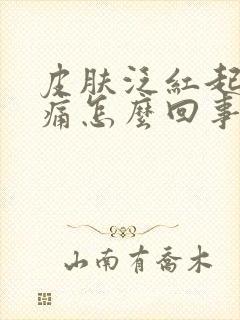 皮肤泛红起皮刺痛怎么回事封面