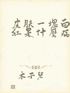 皮肤一块白一块红是什么病封面