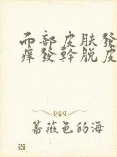 面部皮肤发红发痒发干脱皮