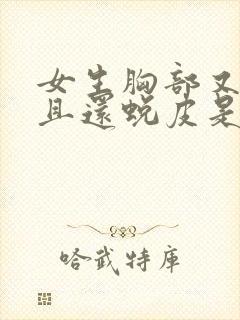 女生胸部又痒而且还蜕皮是怎么回事