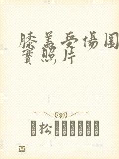 膝盖受伤图片真实照片