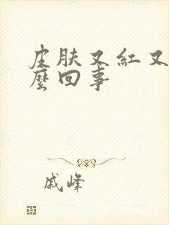 皮肤又红又痒怎么回事