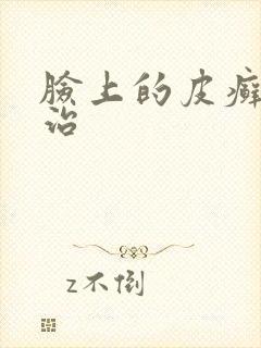 脸上的皮癣怎么治