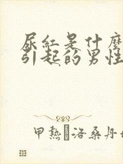 尿红是什么原因引起的男性封面