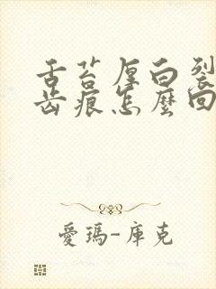 舌苔厚白裂纹有齿痕怎么回事