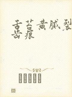 舌苔黄腻裂纹有齿痕封面